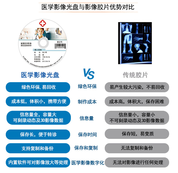医学影像光盘与影像胶片优势对比 医学影像光盘与影像胶片优势对比